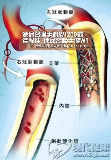 使命召唤手游W1200最佳配件 使命召唤手游W1200皮肤|世界杯直播